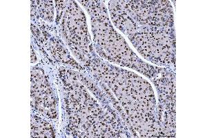 IHC analysis of MBNL1 using anti-MBNL1 antibody (ABIN7602608). (MBNL1 anticorps  (AA 89-388))