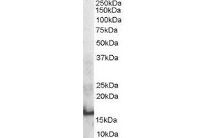 ABIN2559907 staining (0. (SH2D1A anticorps  (Internal Region))