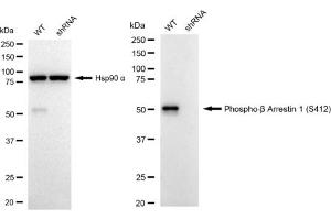 Western blotting analysis using Phospho-beta Arrestin 1 (S412) antibody (ABIN7797654).