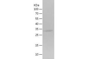 Western Blotting (WB) image for Glycoprotein Hormones, alpha Polypeptide (CGA) (AA 25-116) protein (His-IF2DI Tag) (ABIN7123167)
