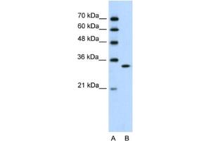 Western Blotting (WB) image for anti-Ribonuclease H2, Subunit A (RNASEH2A) antibody (ABIN2462212) (RNASEH2A anticorps)