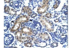 Image no. 1 for anti-SIX Homeobox 6 (SIX6) (AA 41-90) antibody (ABIN6735817)