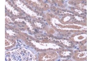 DAB staining on IHC-P; Samples: Human Kidney Tissue (ZNF10 anticorps  (AA 1-244))