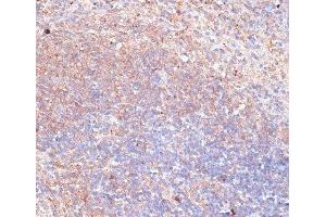 Immunohistochemistry of paraffin-embedded Mouse spleen using TMX1 Polyclonal Antibody at dilution of 1:100 (40x lens). (TMX1 anticorps)