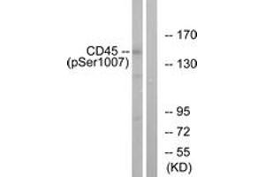 Western blot analysis of extracts from HeLa cells treated with TNF 20ng/ml 15', using CD45 (Phospho-Ser1007) Antibody.
