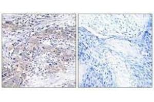 Immunohistochemistry analysis of paraffin-embedded human cervix tissue using CLN6 antibody. (CLN6 anticorps)