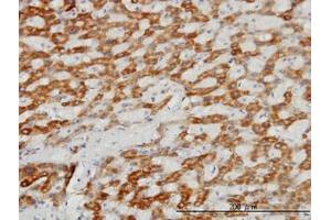 Image no. 1 for anti-Translocase of Inner Mitochondrial Membrane 8A (TIMM8A) (AA 9-98) antibody (ABIN598643) (TIMM8A/DDP anticorps  (AA 9-98))