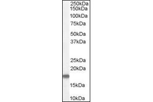 Image no. 1 for anti-Stathmin 1 (STMN1) (C-Term) antibody (ABIN374648) (Stathmin 1 anticorps  (C-Term))