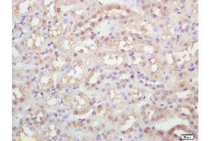 Formalin-fixed and paraffin embedded rat kidney labeled with Rabbit Anti KIFC1 Polyclonal Antibody, Unconjugated (ABIN873143) at 1:200 followed by conjugation to the secondary antibody and DAB staining