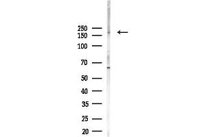 anti-Laminin, beta 2 (Laminin S) (LAMB2) (N-Term) antibody