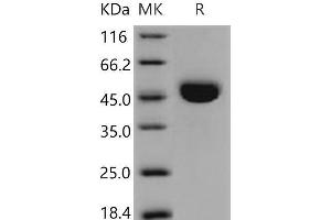 Western Blotting (WB) image for Cathepsin E (CTSE) (AA 1-397) protein (His tag) (ABIN7194677)