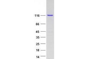 Validation with Western Blot
