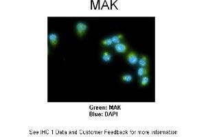 Sample Type :  Human lung adenocarcinoma cell line A549  Primary Antibody Dilution :  1:100  Secondary Antibody :  Goat anti-rabbit AlexaFluor 488  Secondary Antibody Dilution :  1:400  Color/Signal Descriptions :  MAK: Green DAPI:Blue  Gene Name :  MAK   Submitted by :  Dr. (MAK anticorps  (C-Term))