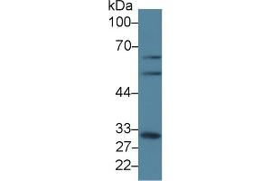 Detection of GCLM in Human A431 cell lysate using Polyclonal Antibody to Glutamate Cysteine Ligase, Modifier Subunit (GCLM) (GCLM anticorps  (AA 40-251))