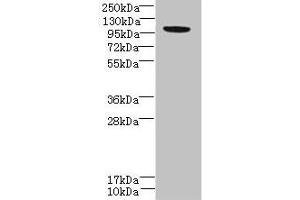 Western blot All lanes: PPFIBP2 antibody at 6 μg/mL + HepG2 whole cell lysate Secondary Goat polyclonal to rabbit at 1/10000 dilution Predicted band size: 99, 87, 84 kDa Observed band size: 99 kDa (PPFIBP2 anticorps  (AA 101-400))