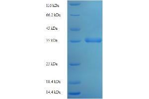 SDS-PAGE (SDS) image for MpV17 Mitochondrial Inner Membrane Protein (MPV17) (AA 1-176), (full length) protein (His-SUMO Tag) (ABIN5709955)
