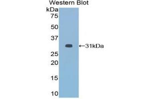 Detection of Recombinant HDAC6, Mouse using Polyclonal Antibody to Histone Deacetylase 6 (HDAC6) (HDAC6 anticorps  (AA 560-811))
