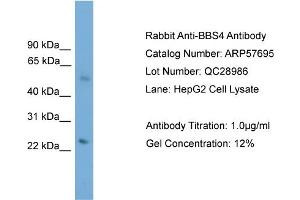 WB Suggested Anti-BBS4  Antibody Titration: 0. (BBS4 anticorps  (N-Term))