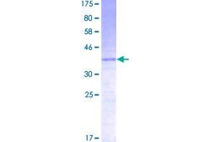 Image no. 1 for Chemokine (C-C Motif) Ligand 21 (CCL21) (AA 1-134) protein (GST tag) (ABIN1348392)