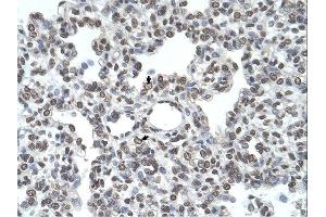 TMPRSS11D antibody was used for immunohistochemistry at a concentration of 4-8 ug/ml. (TMPRSS11D anticorps  (N-Term))