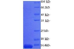 Metallo-beta-Lactamase (NDM-1) (AA 88-146), (partial) protein (His tag)
