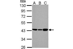WB Image ACADM antibody detects ACADM protein by Western blot analysis. (Medium-Chain Specific Acyl-CoA Dehydrogenase, Mitochondrial (Center) anticorps)