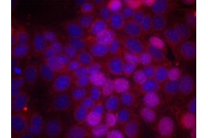 Immunofluorescence staining of methanol-fixed MCF-7 cells using Phospho-ESR1-S106 antibody (ABIN2988004). (Estrogen Receptor alpha anticorps  (pSer106))