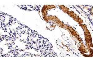 Detection of MYO in Mouse Lung Tissue using Polyclonal Antibody to Myoglobin (MYO)