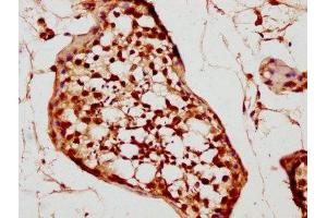 IHC image of ABIN7161945 diluted at 1:200 and staining in paraffin-embedded human testis tissue performed on a Leica BondTM system. (TNP2 anticorps  (AA 1-138))