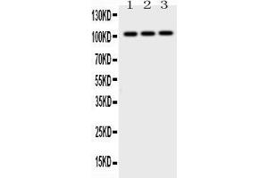 Western blot analysis of AP2B1 expression in rat testis extract ( Lane 1), mouse brain extract ( Lane 2) and MCF-7 whole cell lysates ( Lane 3).