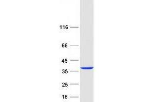 Tropomyosin 4 (TPM4) (Transcript Variant 2) protein (Myc-DYKDDDDK Tag)