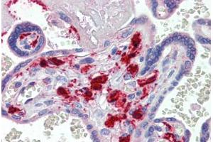 Human Placenta (formalin-fixed, paraffin-embedded) stained with F13A1 antibody ABIN462397 followed by biotinylated secondary antibody, alkaline phosphatase-streptavidin and chromogen. (F13A1 anticorps)