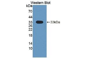 Western blot analysis of the recombinant protein. (DSTYK anticorps  (AA 650-904))