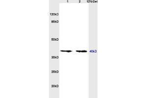 L1 mouse brain, L2 mouse kidney lysates probed (ABIN725960) at 1:200 in 4 °C. (OPRL1 anticorps  (AA 1-47))