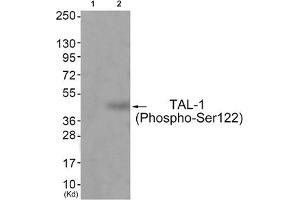 Western blot analysis of extracts from JK cells (Lane 2), using TAL-1 (Phospho-Ser122) Antibody. (TAL1 anticorps  (pSer122))