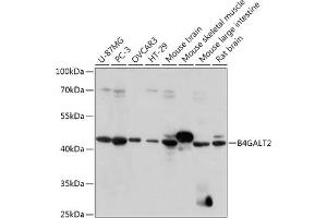 Western blot analysis of extracts of various cell lines, using B4G antibody (ABIN7271198) at 1:1000 dilution.