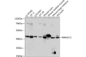 Western blot analysis of extracts of various cell lines, using B4G antibody (ABIN7271198) at 1:1000 dilution. (B4GALT2 anticorps  (AA 155-271))