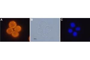 Expression of OX1R in human colon cancer cell lines - Immunocytochemical staining of paraformaldehyde fixed and permeabilized human Colo-205 colon cancer cells A. (HCRTR1 anticorps  (AA 256-269))