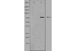 Western blot analysis of extracts from HUVEC, using SKIL antibody. (SKIL anticorps  (C-Term))