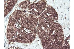 Image no. 7 for anti-CNDP Dipeptidase 2 (Metallopeptidase M20 Family) (CNDP2) antibody (ABIN1497548) (CNDP2 anticorps)