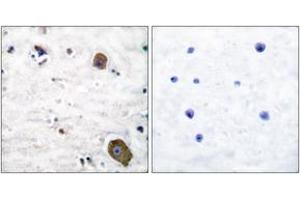 Immunohistochemistry analysis of paraffin-embedded human brain tissue, using GFR alpha-1 Antibody. (GFRA1 anticorps  (AA 51-100))