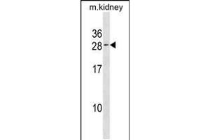 Western blot analysis in kidney cell line lysates (35ug/lane). (VPS25 anticorps  (C-Term))