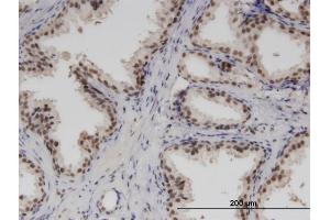 Immunoperoxidase of monoclonal antibody to RBM6 on formalin-fixed paraffin-embedded human prostate. (RBM6 anticorps  (AA 1024-1123))