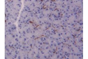 Detection of FABP4 in Mouse Pancreas Tissue using Polyclonal Antibody to Fatty Acid Binding Protein 4 (FABP4)