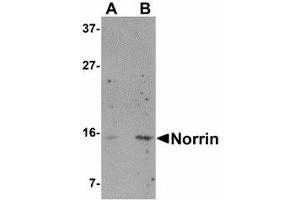 Image no. 1 for anti-Norrie Disease (Pseudoglioma) (NDP) (N-Term) antibody (ABIN478068) (Norrie Disease (Pseudoglioma) anticorps  (N-Term))