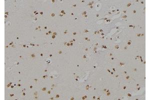 ABIN6277140 at 1/100 staining Human brain tissue by IHC-P. (ALOX5 anticorps  (C-Term))