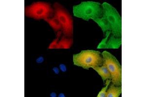 ABIN7096261 and ABIN7100323 staining  cells by IF/ICC. (SLC25A43 anticorps)