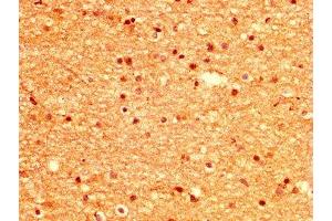 IHC image of ABIN7168378 diluted at 1:500 and staining in paraffin-embedded human brain tissue performed on a Leica BondTM system. (MSI1 anticorps  (AA 221-347))