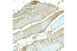 Immunohistochemistry of paraffin-embedded rat skeletal muscle using MYH4 antibody (ABIN7268749) at dilution of 1:150 (40x lens).