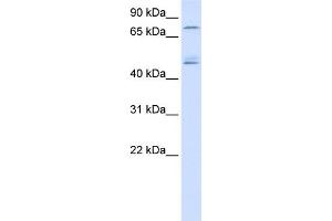 WB Suggested Anti-DDX1 Antibody Titration:  0. (DDX1 anticorps  (N-Term))